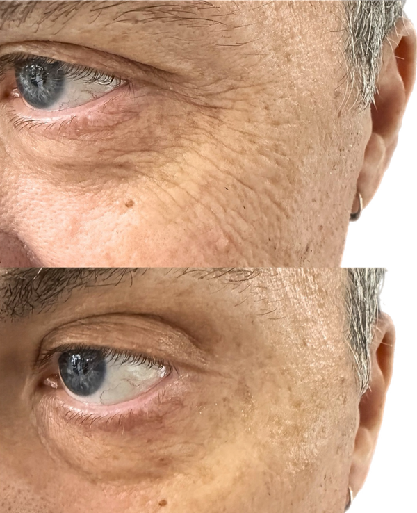 Glow Serum