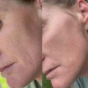 Glow Serum