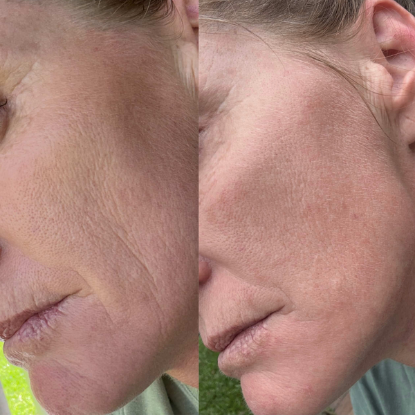 Glow Serum