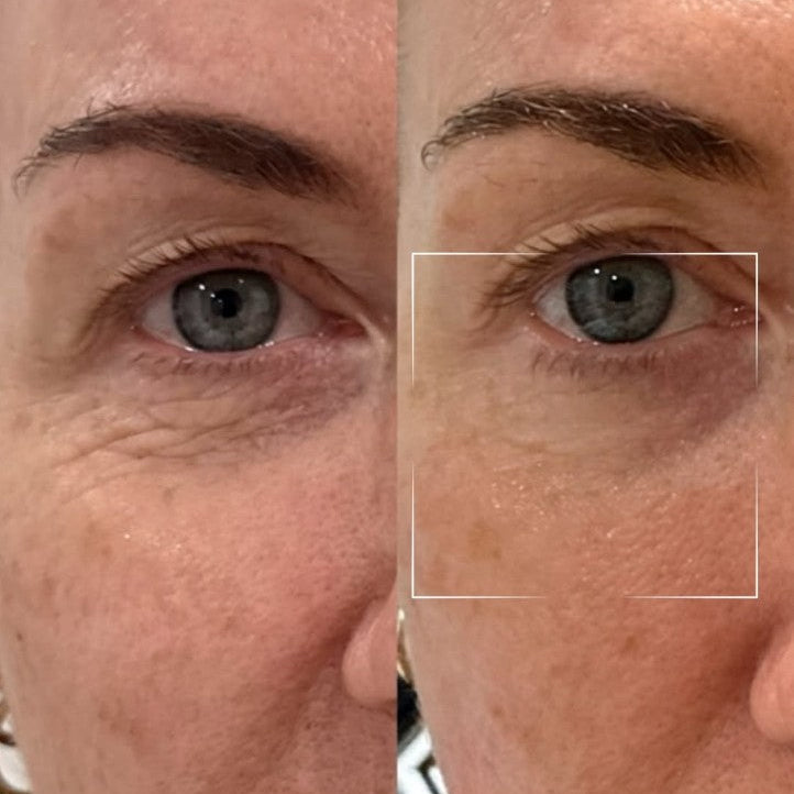 Before . After 5 Minutes 