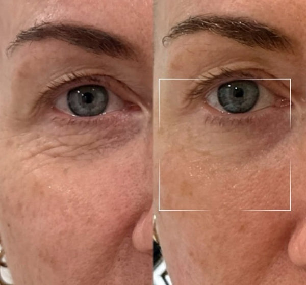 Glow Serum