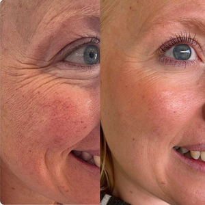 Glow Serum